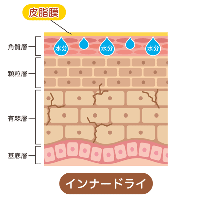 インナードライ肌の断面図