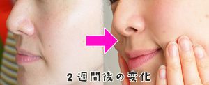 2週間後の変化